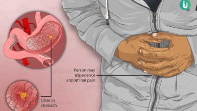 Photo of வயிற்று புண்ணை போக்கும் இயற்கை மருத்துவ குறிப்புகள்!!
