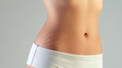 Photo of ஸ்ட்ரெச் மார்க்ஸ் போக இதை ட்ரை பண்ணுங்க !